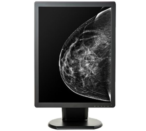 Double Black Imaging 5MP Monochrome Display For Mammography And Tomo